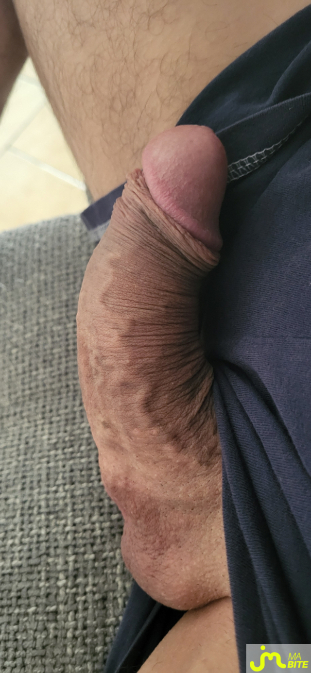 bites de BIGBIDUL