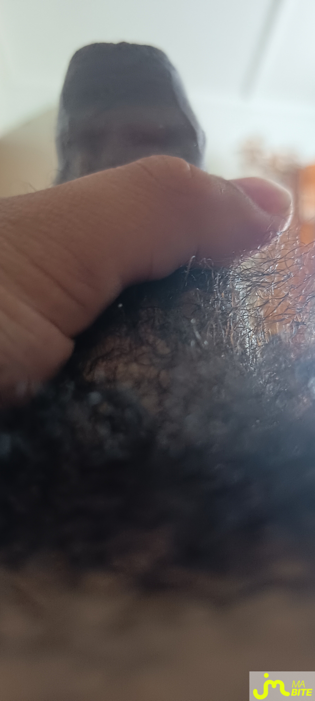 bites de fly9741000