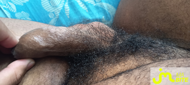 bites de fly9741000