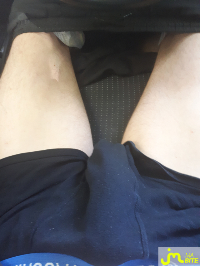 bites de Casper 