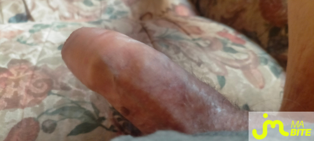 bites de zeub84