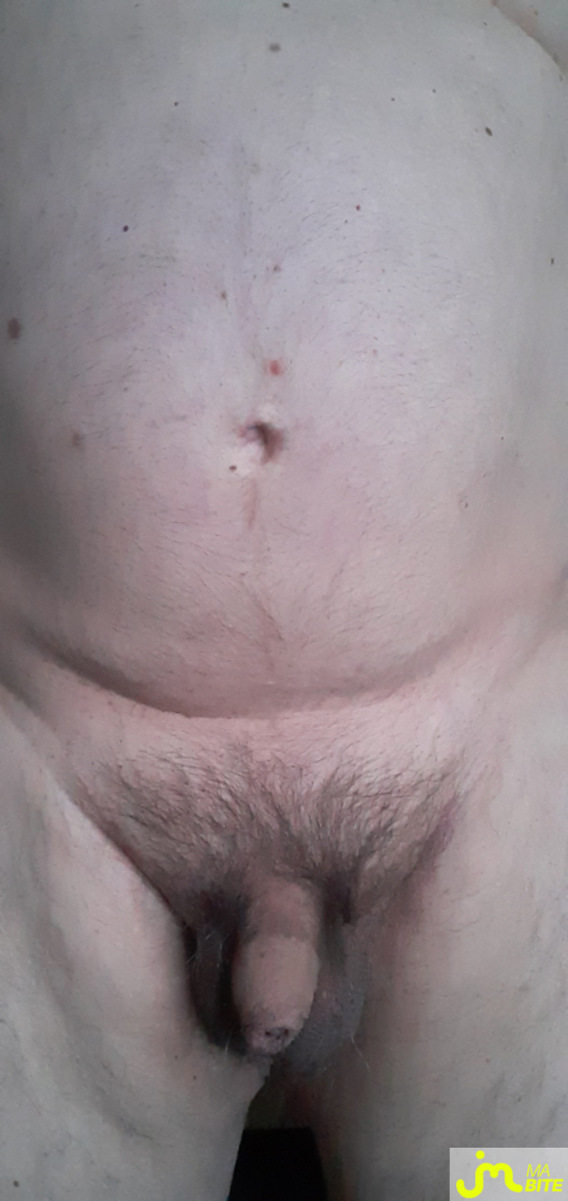 bites de jolicul76