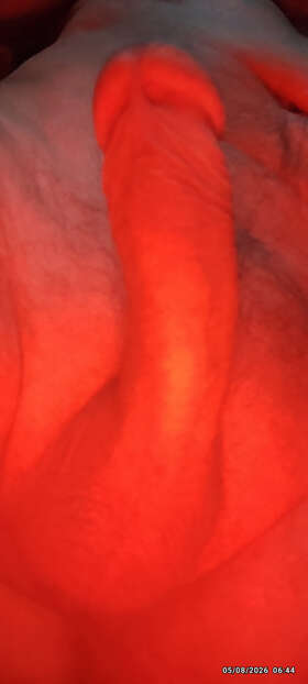 Photos de bites :  Retour tamis&eacute;.