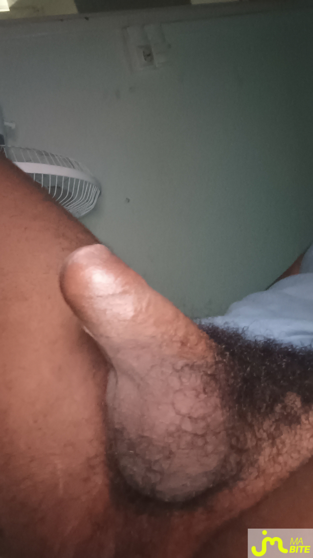 bites de fly9741000