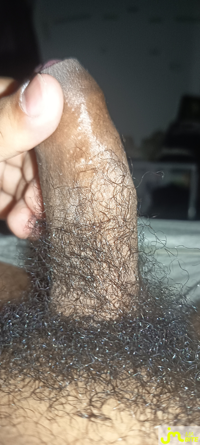 bites de fly9741000