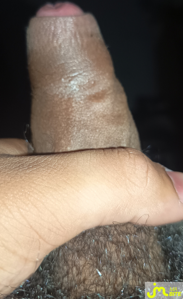 bites de fly9741000