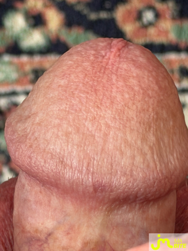 bites de Tonpaul