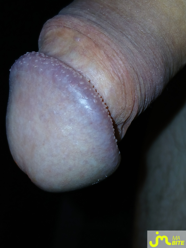 bites de Maximus86