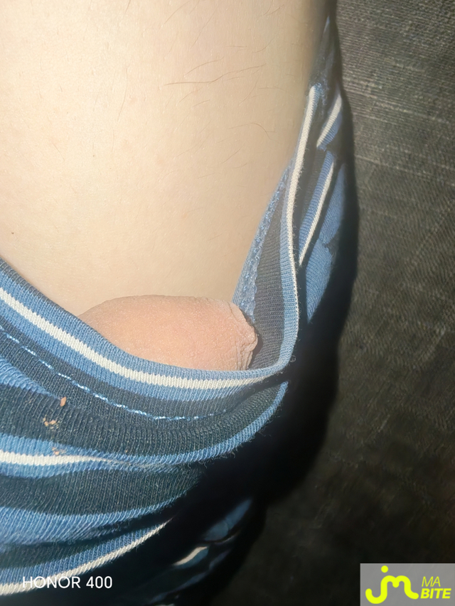 bites de Pen20