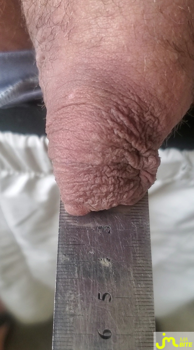 bites de Queute19