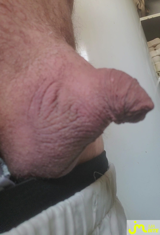 bites de Queute19