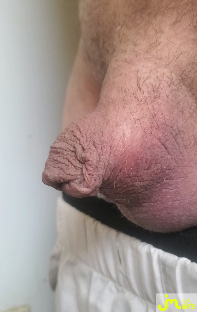 bites de Queute19