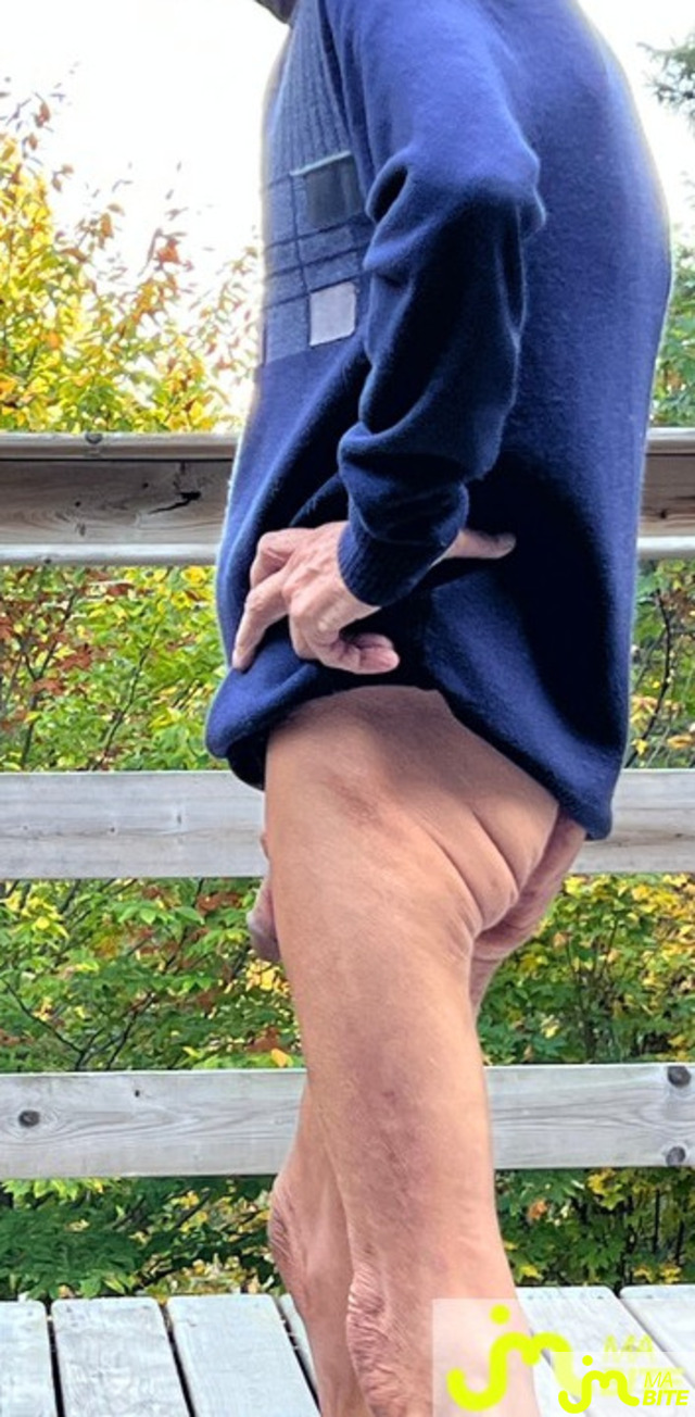 bites de jolie27