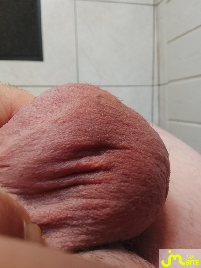bites de orphelines