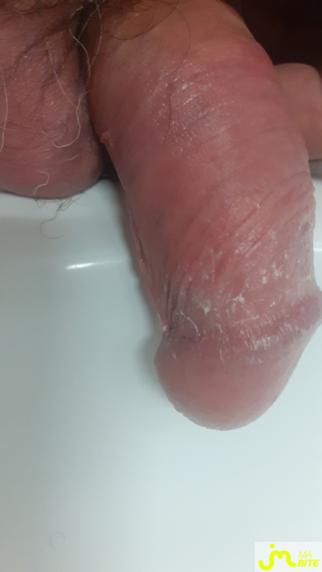 bites de Anneaux 27