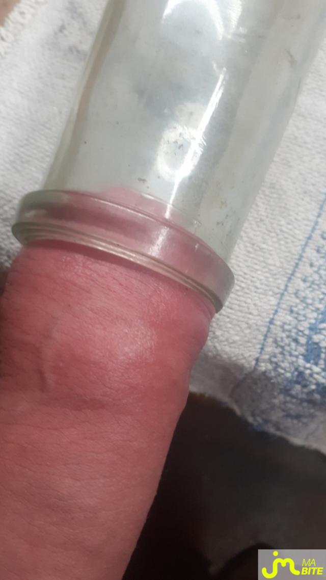 bites de Anneaux 27