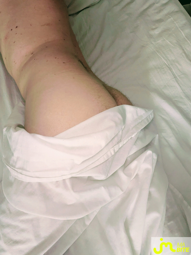 bites de J&egrave;j14