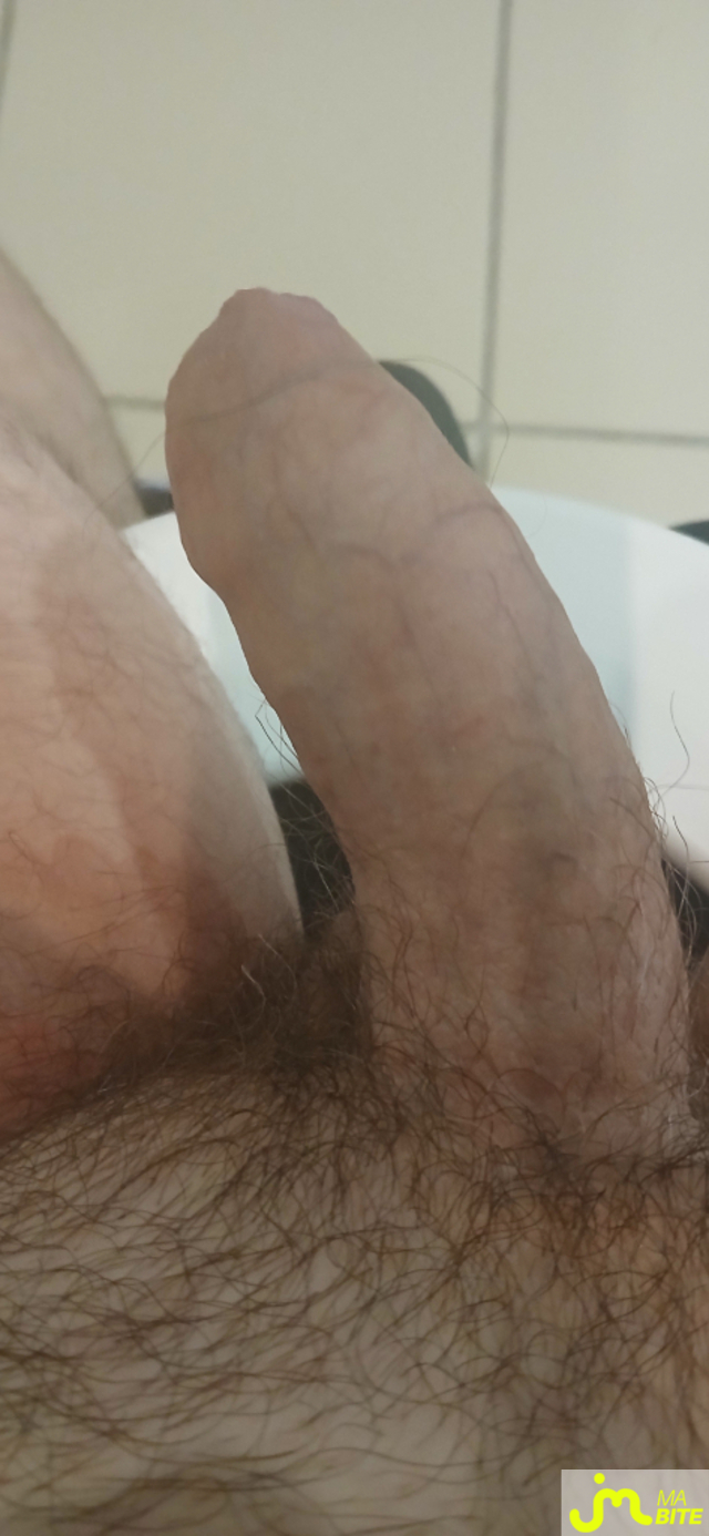 bites de Pat13000