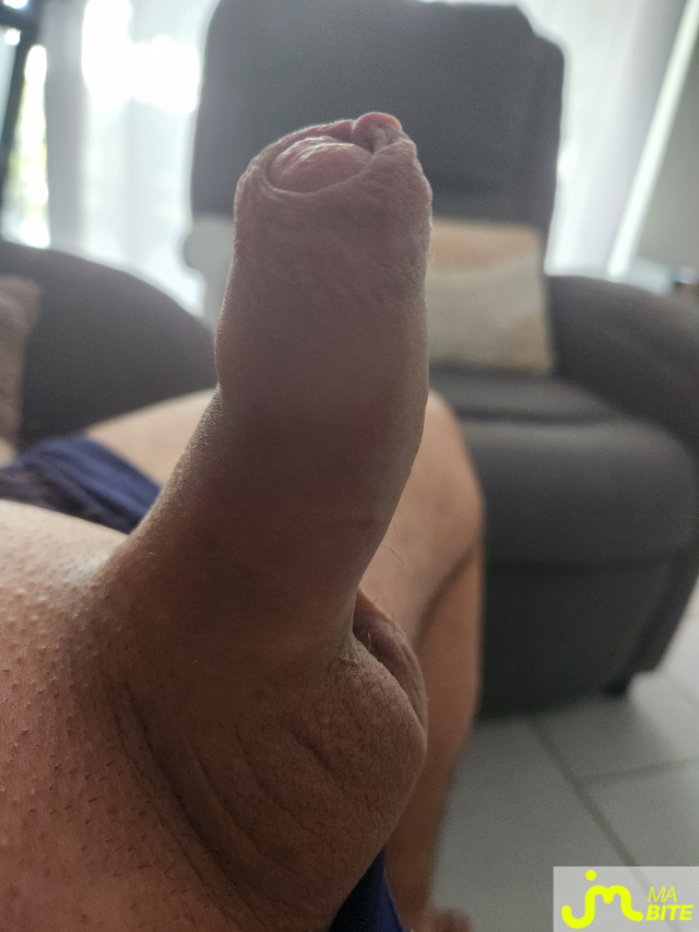 bites de erom