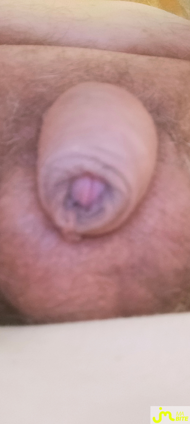 bites de zeub84