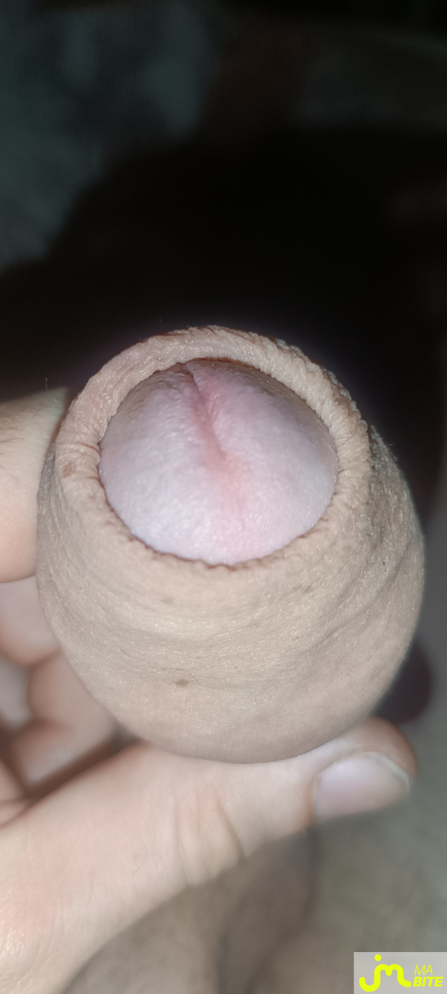 bites de pr&eacute;puce 29