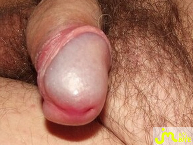 bites de gaynaturiste31