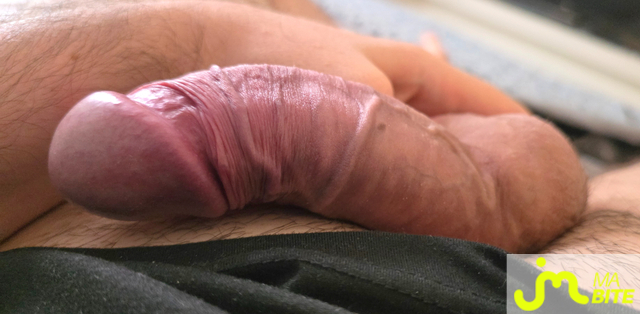 bites de bite_&ocirc;_veines
