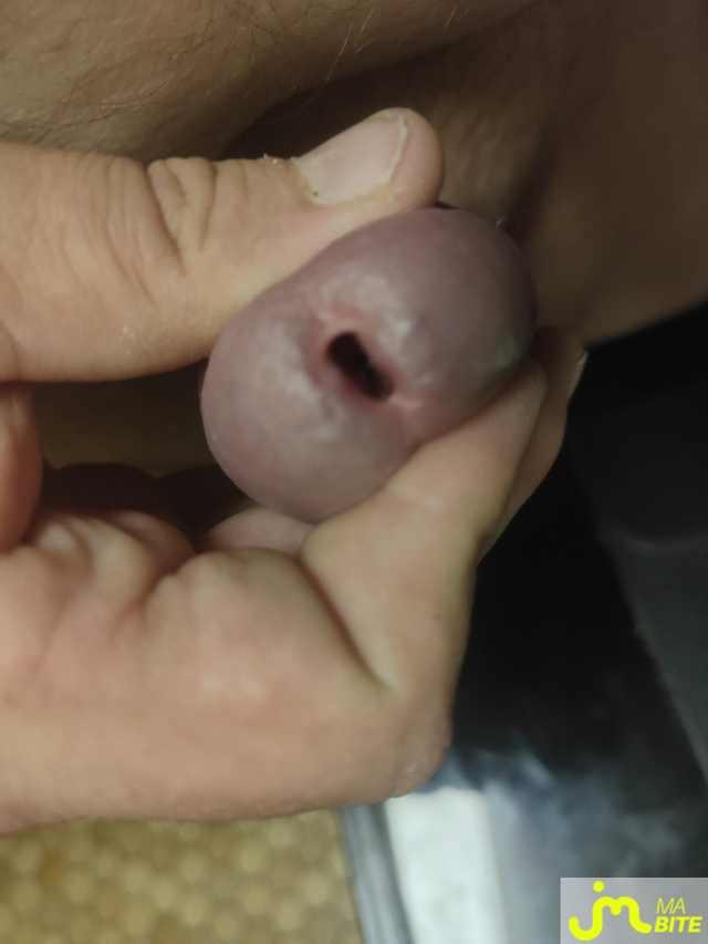 bites de Luuuc8854