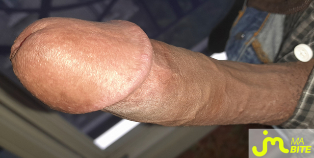 bites de &Eacute;rictismey