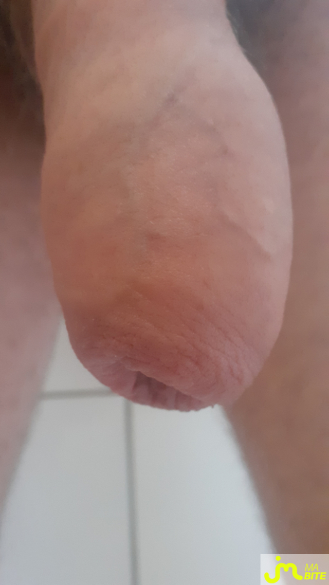 bites de Anneaux 27