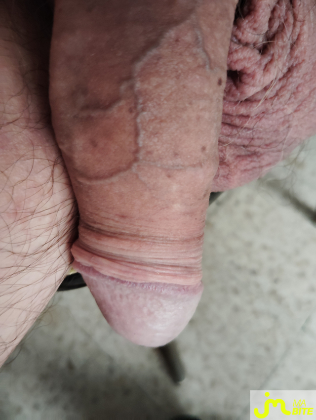 bites de alain30900