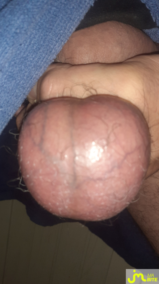 bites de Anneaux 27