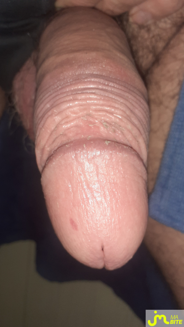 bites de Anneaux 27