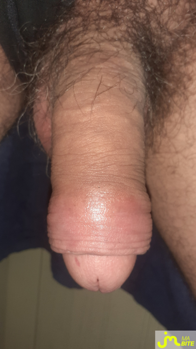 bites de Anneaux 27