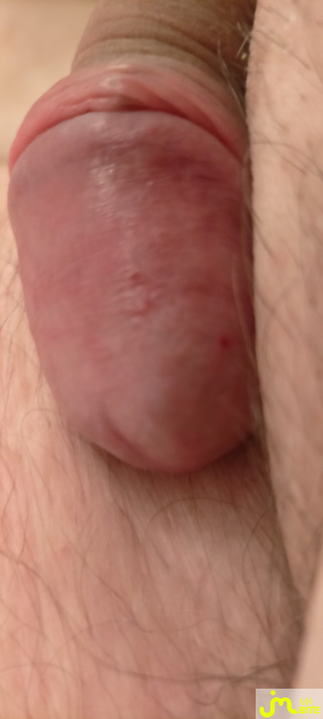 bites de zeub84
