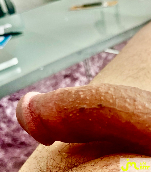 bites de Triky