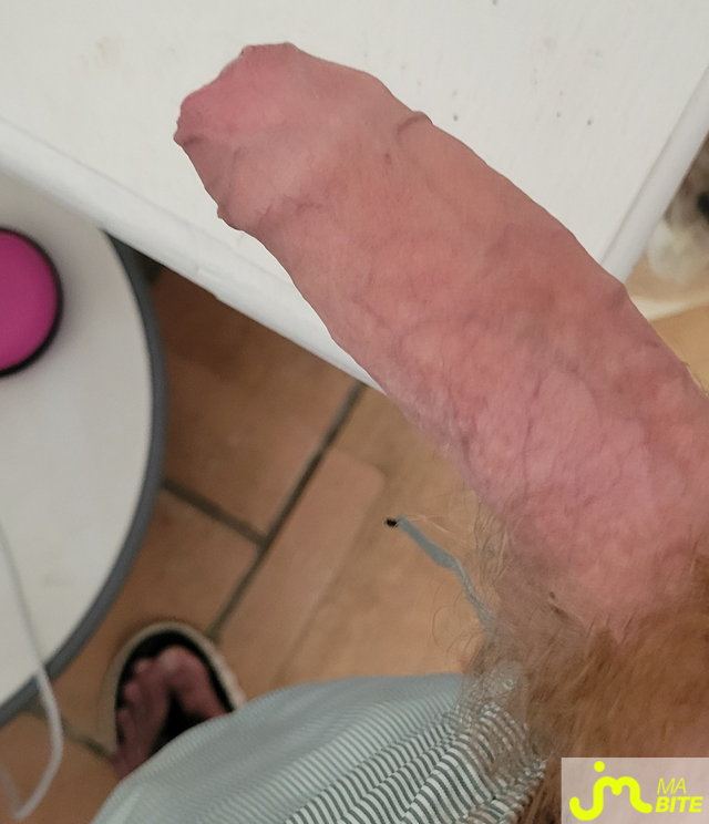 bites de HM59