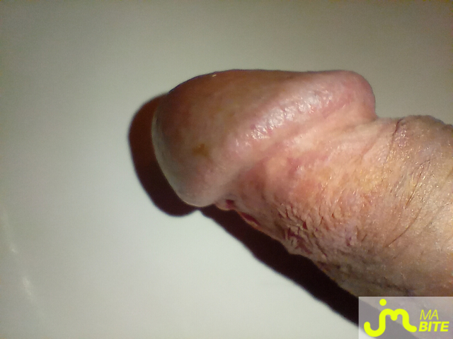 bites de rahan77333