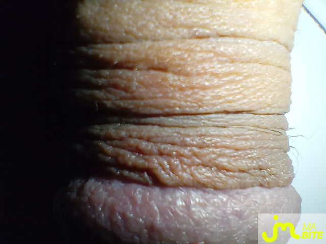 bites de rahan77333