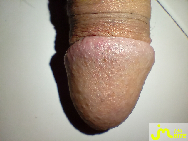 bites de rahan77333