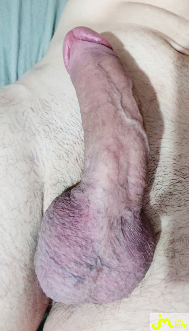bites de Kinatix