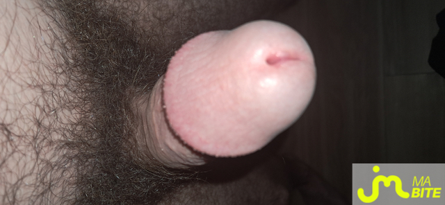 bites de Killian13