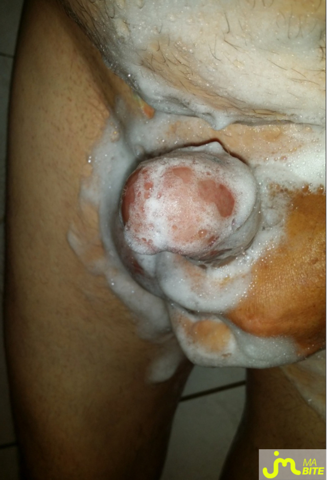 bites de ricou47