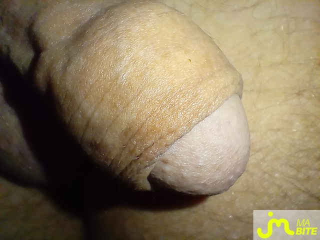 bites de rahan77333