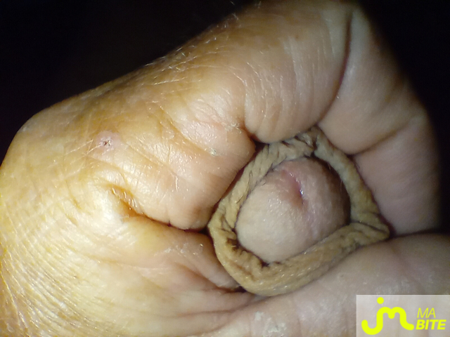 bites de rahan77333