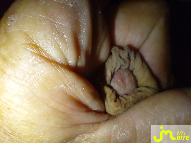 bites de rahan77333