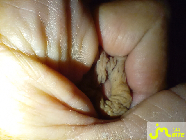 bites de rahan77333