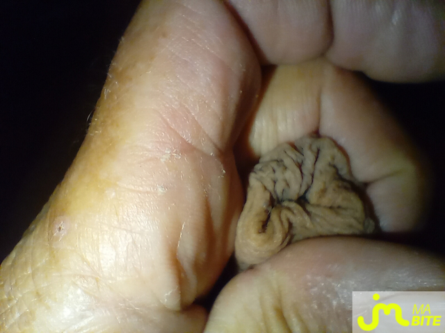 bites de rahan77333