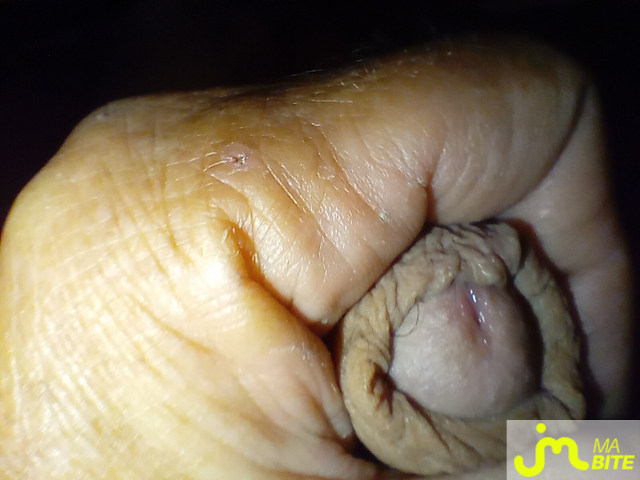 bites de rahan77333