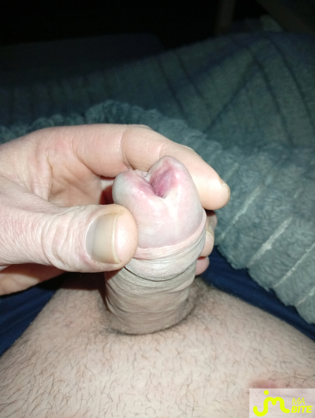 bites de castration83 